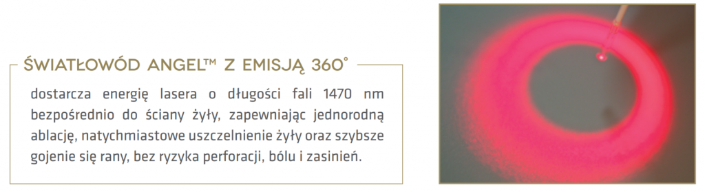 laserowe usuwanie żylaków