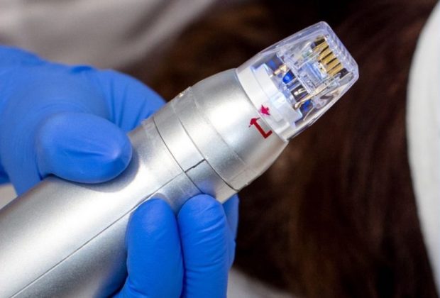 SCARLET S  radiofrekwencja mikroigłowa - JEDYNA WE WROCŁAWIU,  W KREFFT CLINIC